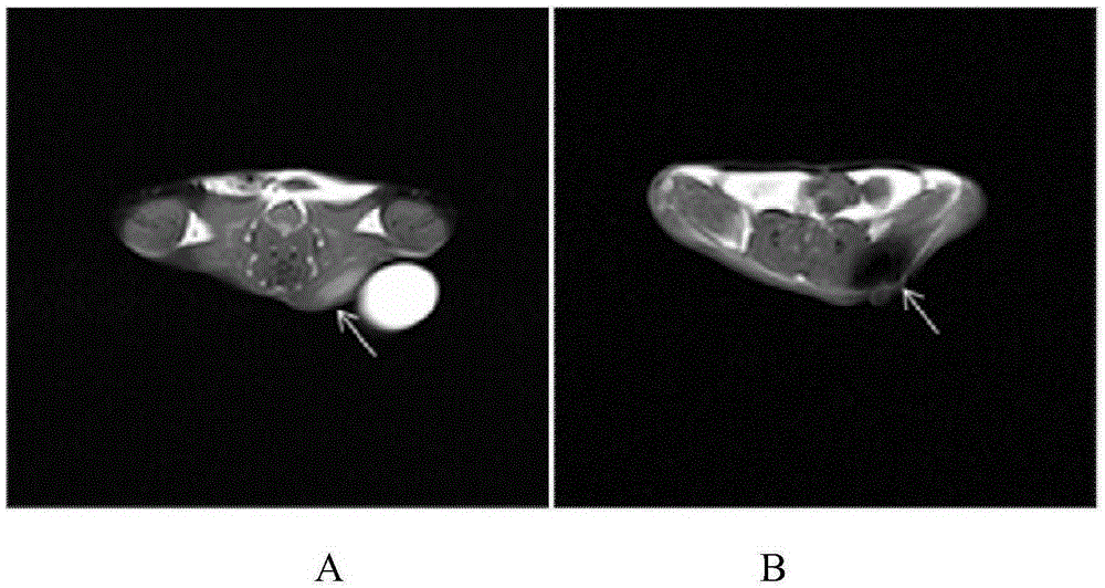 Magnetic resonance imaging detectable liquid embolism composition and its preparation and application