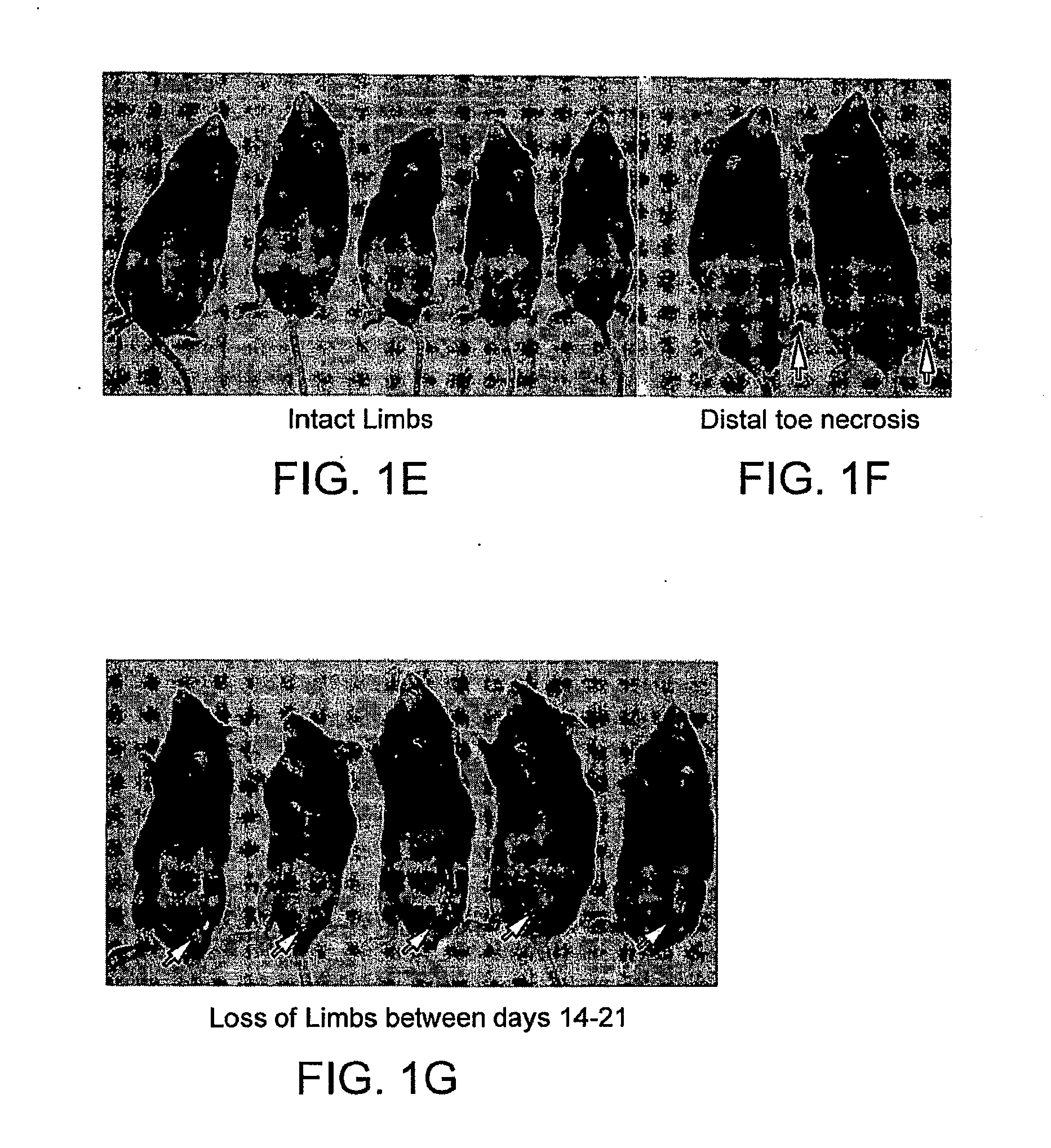 USE OF TUMOR NECROSIS FACTOR-alpha RECEPTOR p75 FOR TREATMENT OF ISCHEMIA-INDUCED NEOVASCULARIZATION