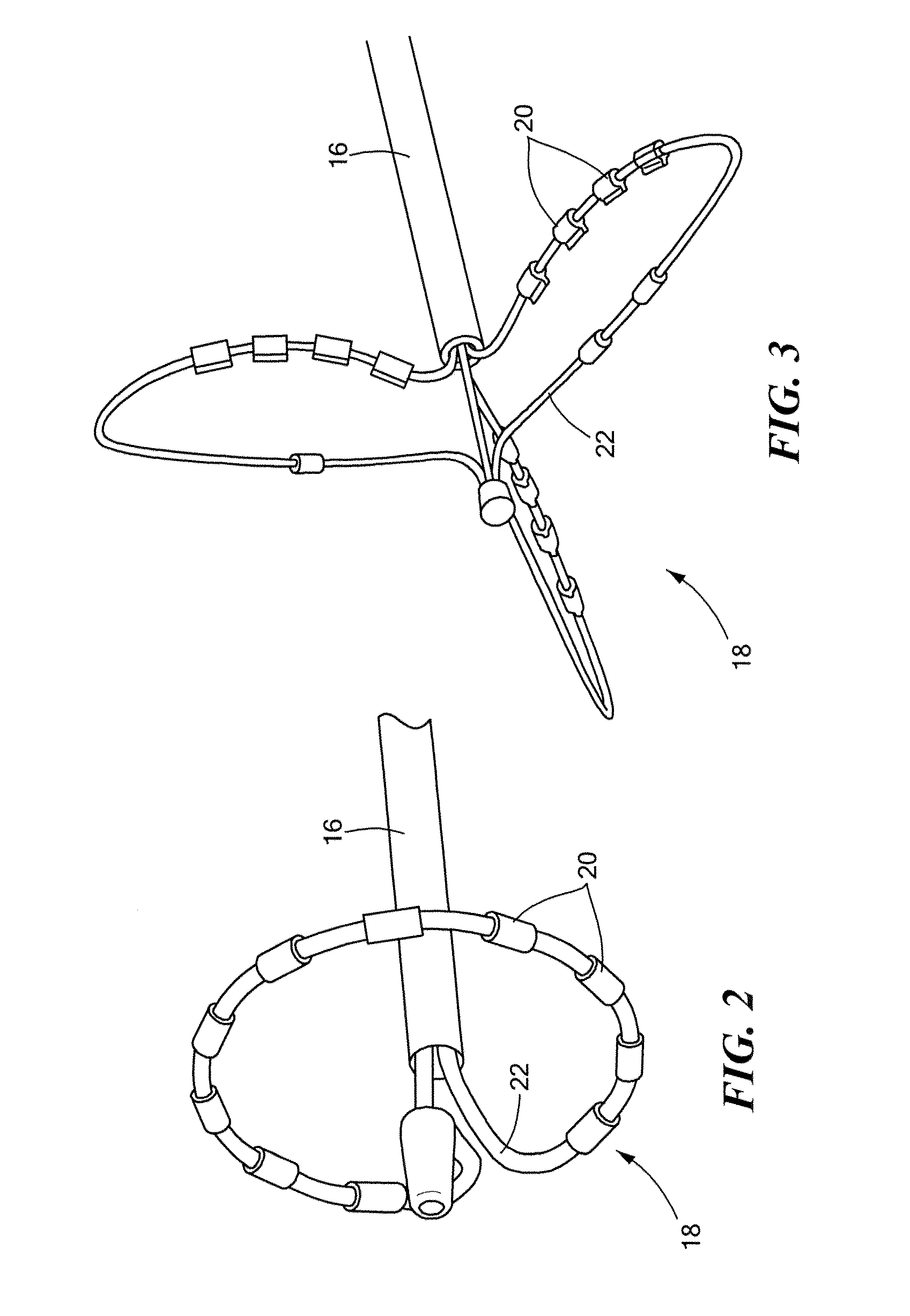 Multipolarity epicardial radiofrequency ablation