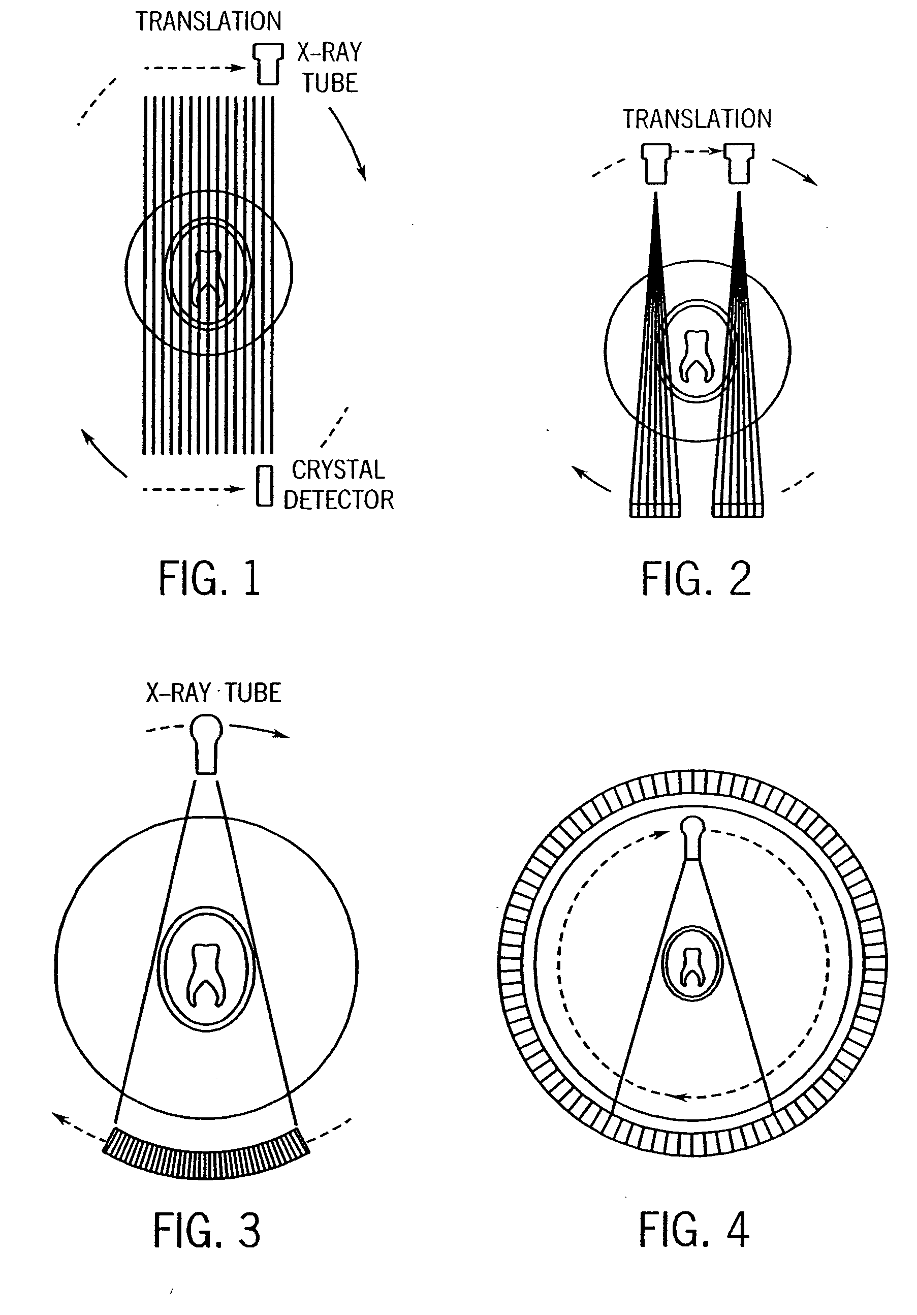 Cone-beam filtered backprojection image reconstruction method for short trajectories