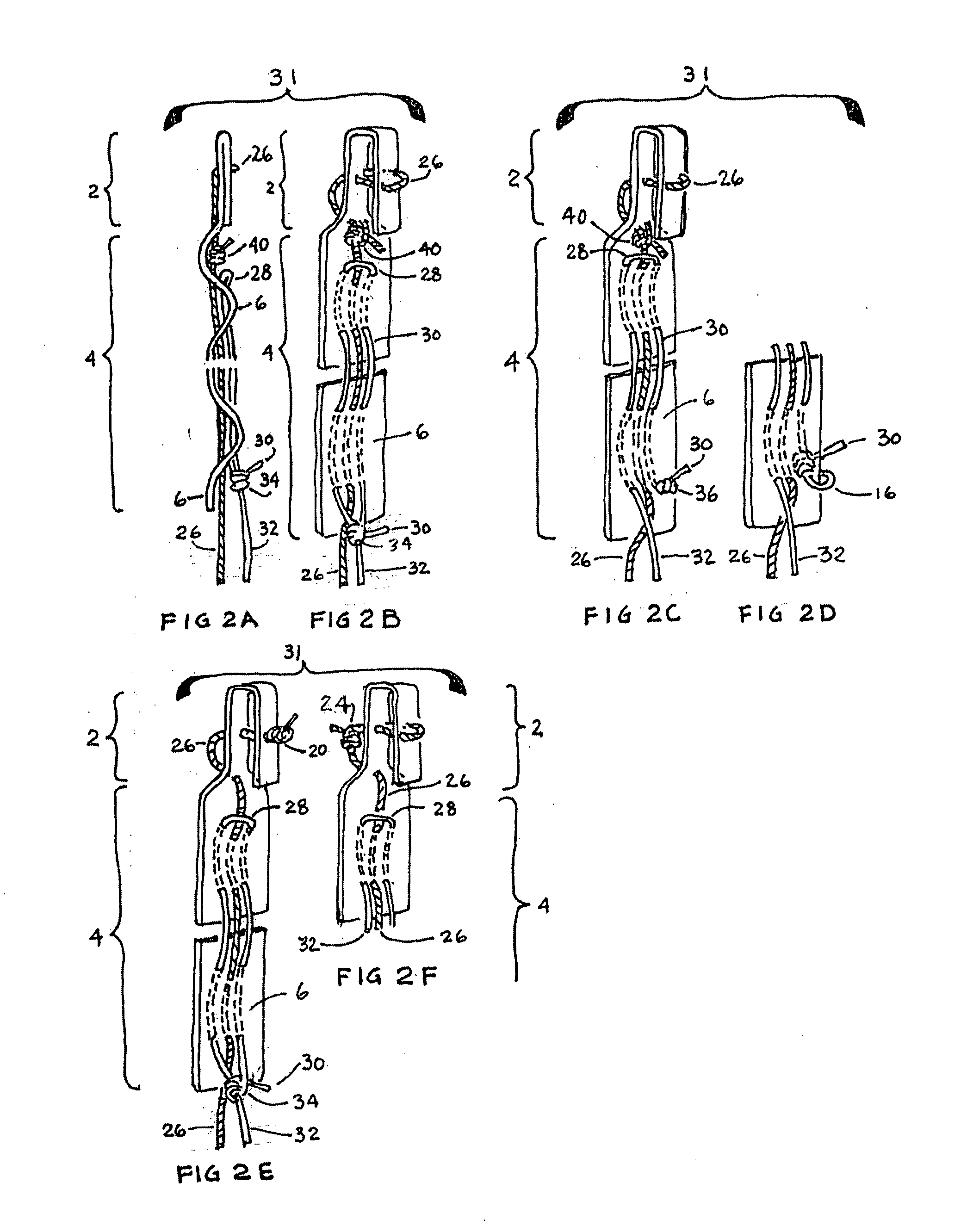 Closure medical device