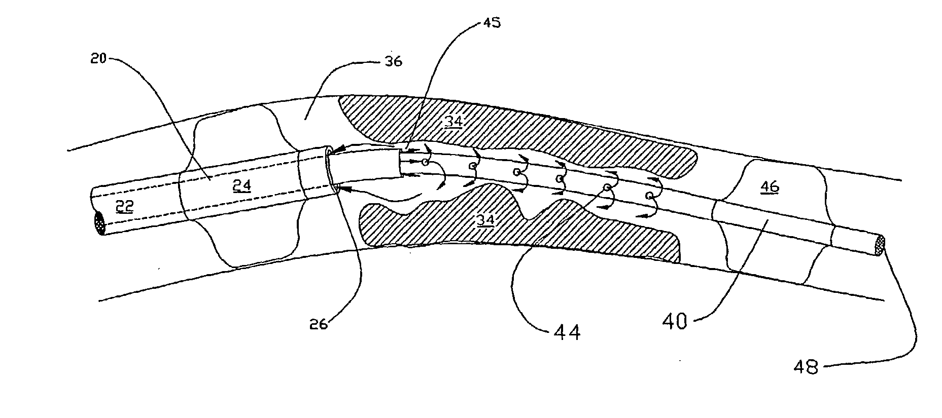 Methods for enhancing fluid flow through an obstructed vascular site, and systems and kits for use in practicing the same