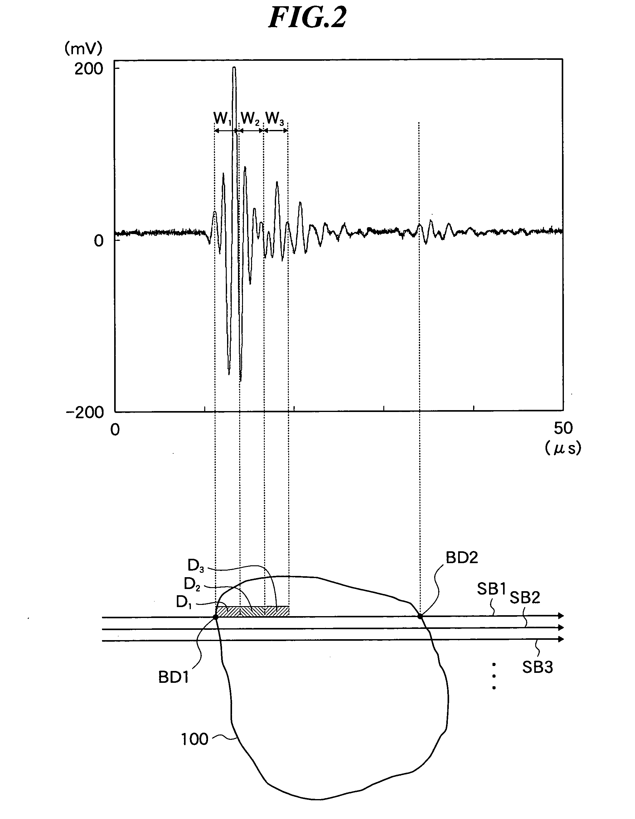 Ultrasonic imaging apparatus