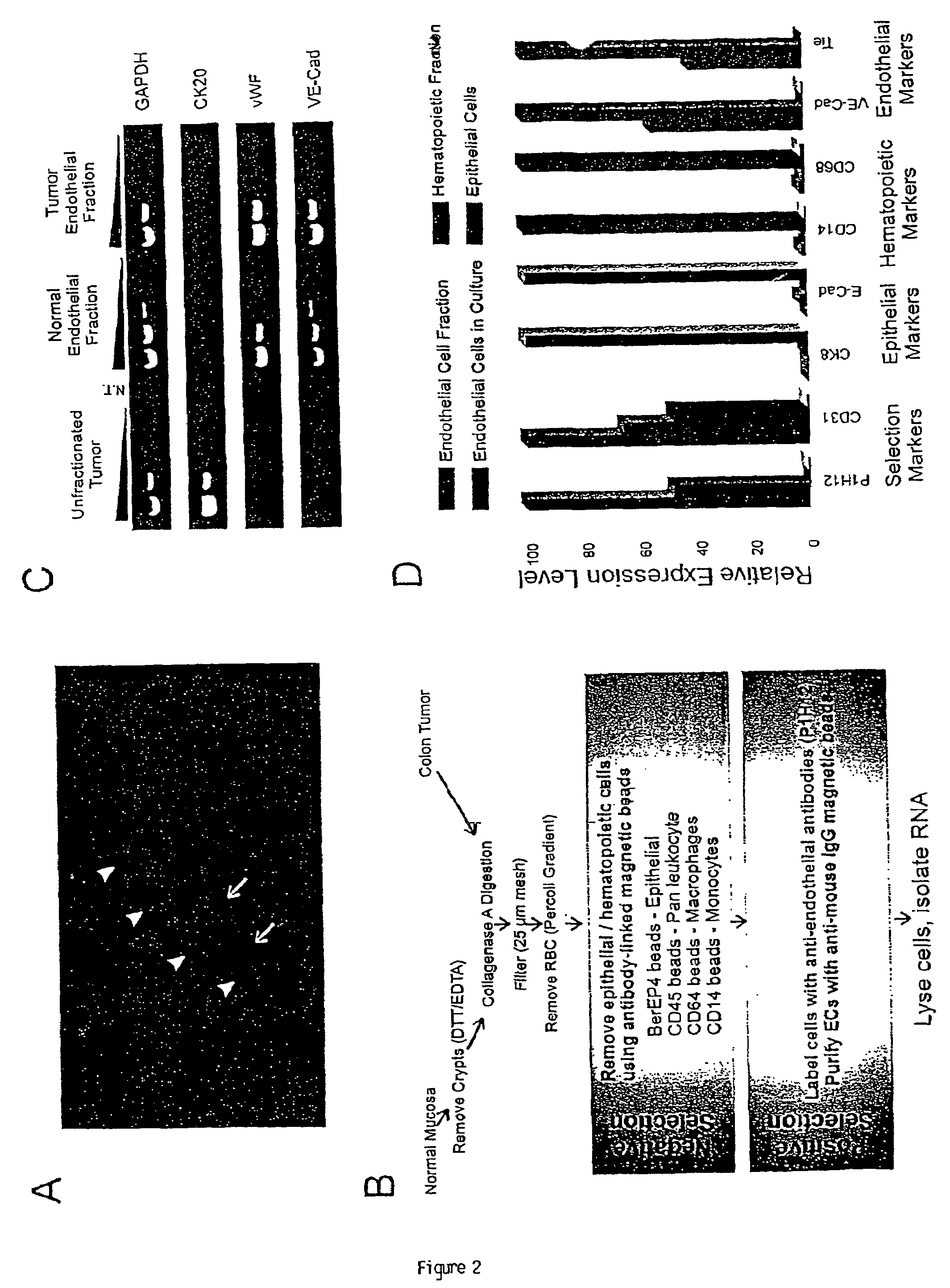 Endothelial cell expression patterns