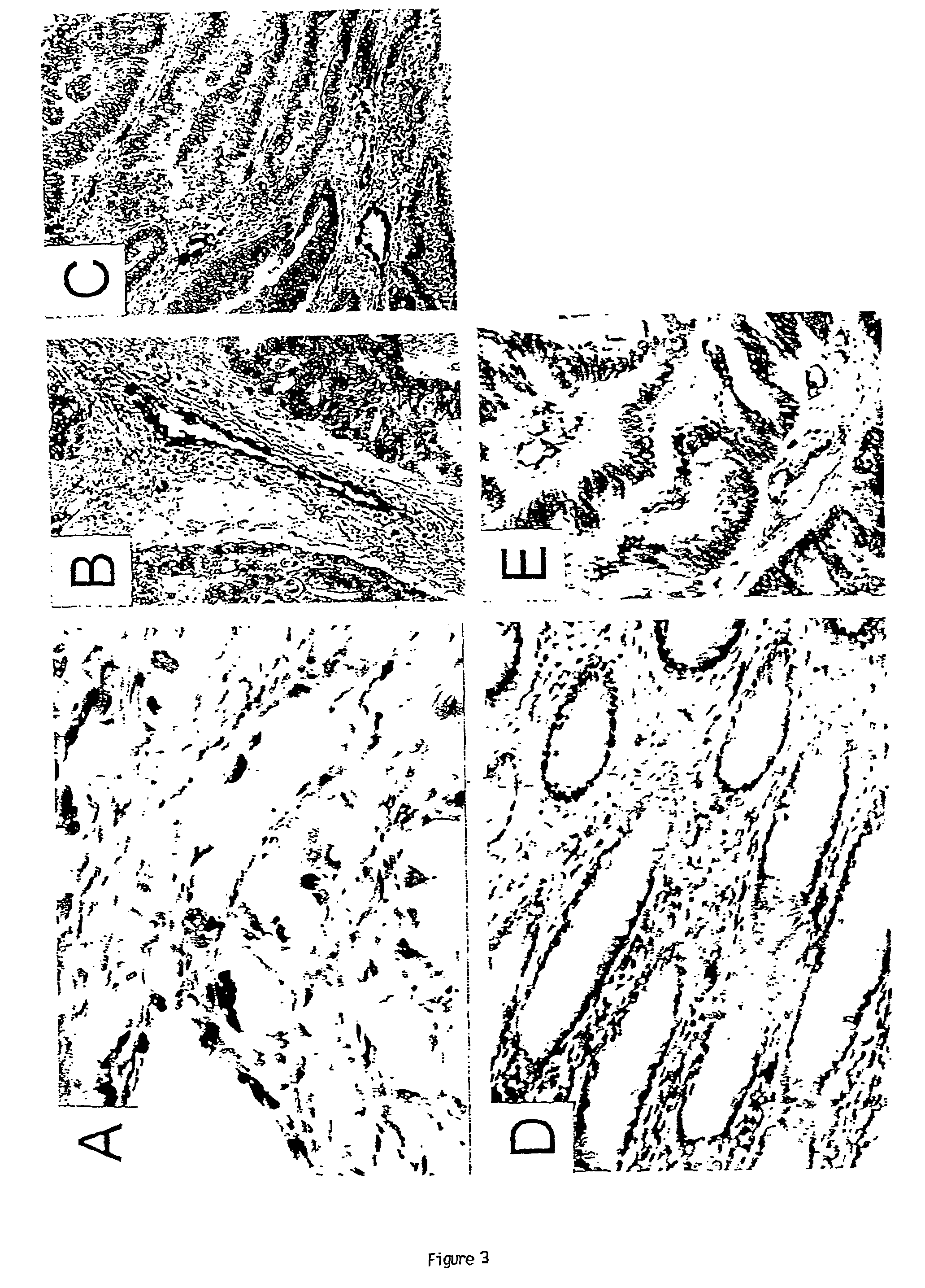 Endothelial cell expression patterns