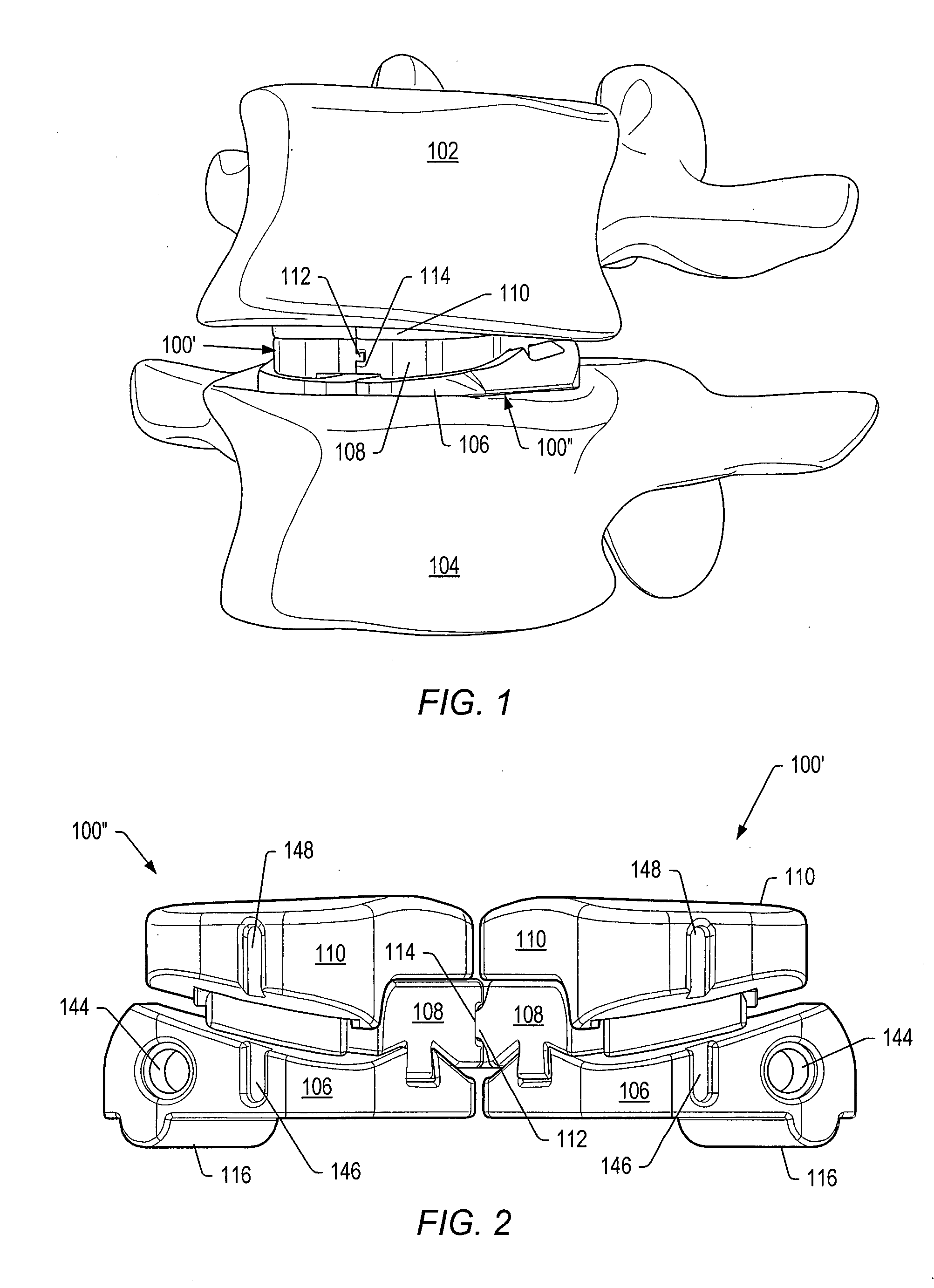 Posterior stabilization systems with shared, dual dampener systems