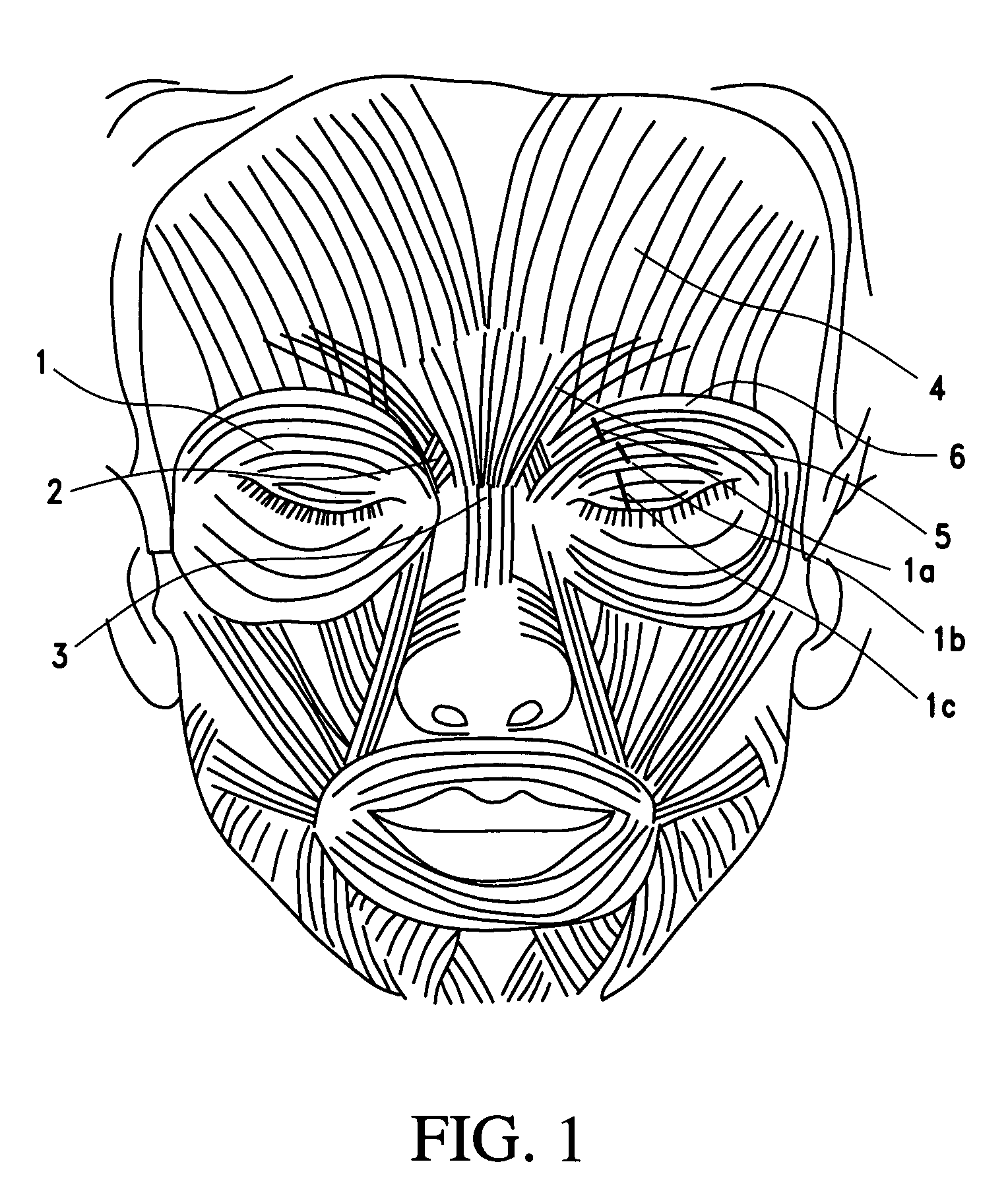 Cosmetic use of botulinum toxin for the treatment of eyebrow and forehead ptosis, and unwanted eyebrow expression