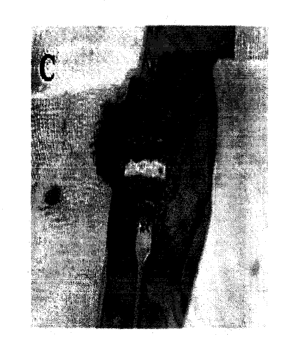 Bone grafting material of gradient porous beta-TCP with bioactivity and anti-infection effect, preparation method and application thereof