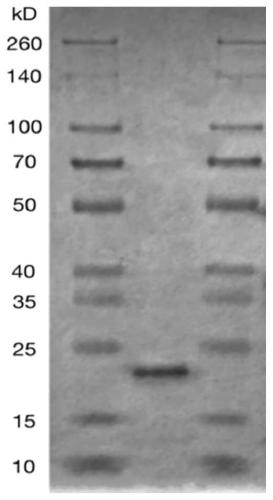 A method for determining the value of c-reactive protein in serum for the purpose of non-disease diagnosis