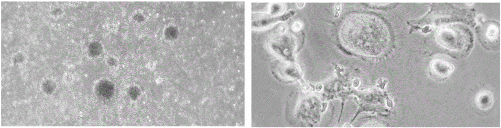 Method for preparing DC-CIK immune cells with efficient tumor killing efficiency and prepared DC-CIK immune cells