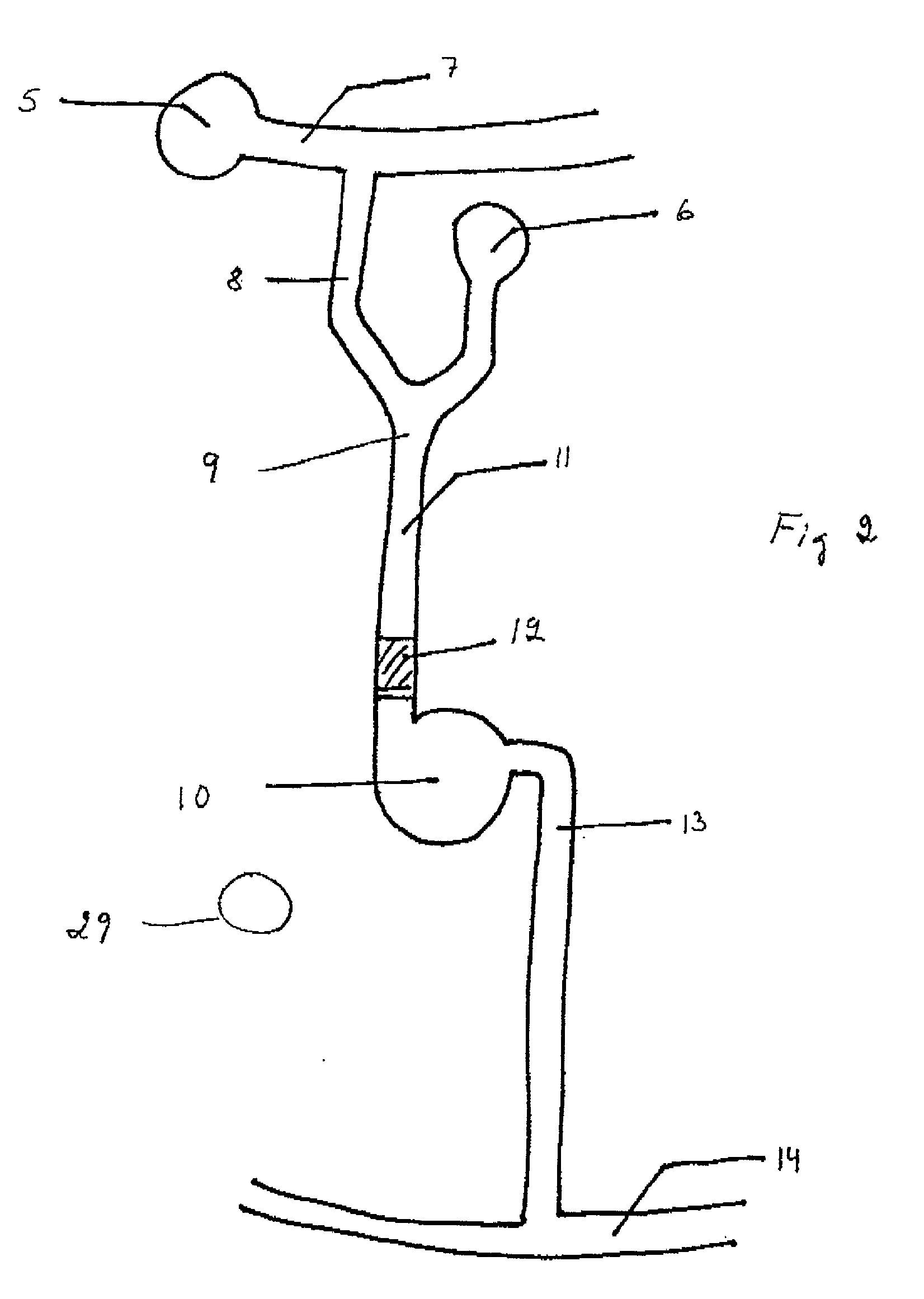 Microfludic system (EDI)