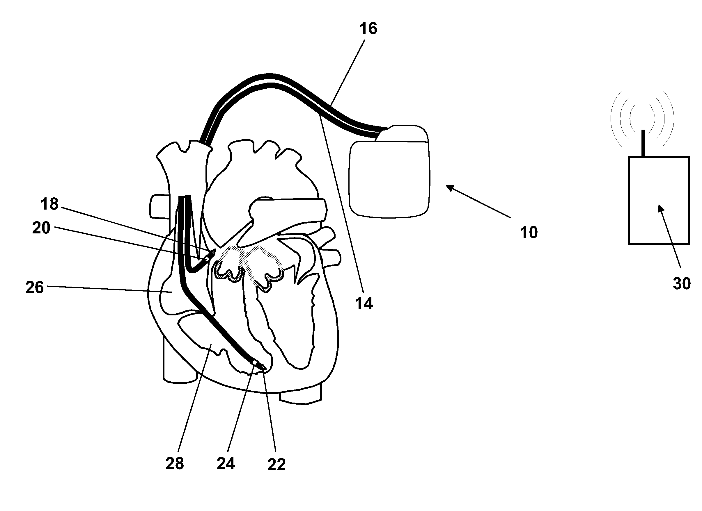 Technique for determining signal quality in a physiologic sensing system using high frequency sampling