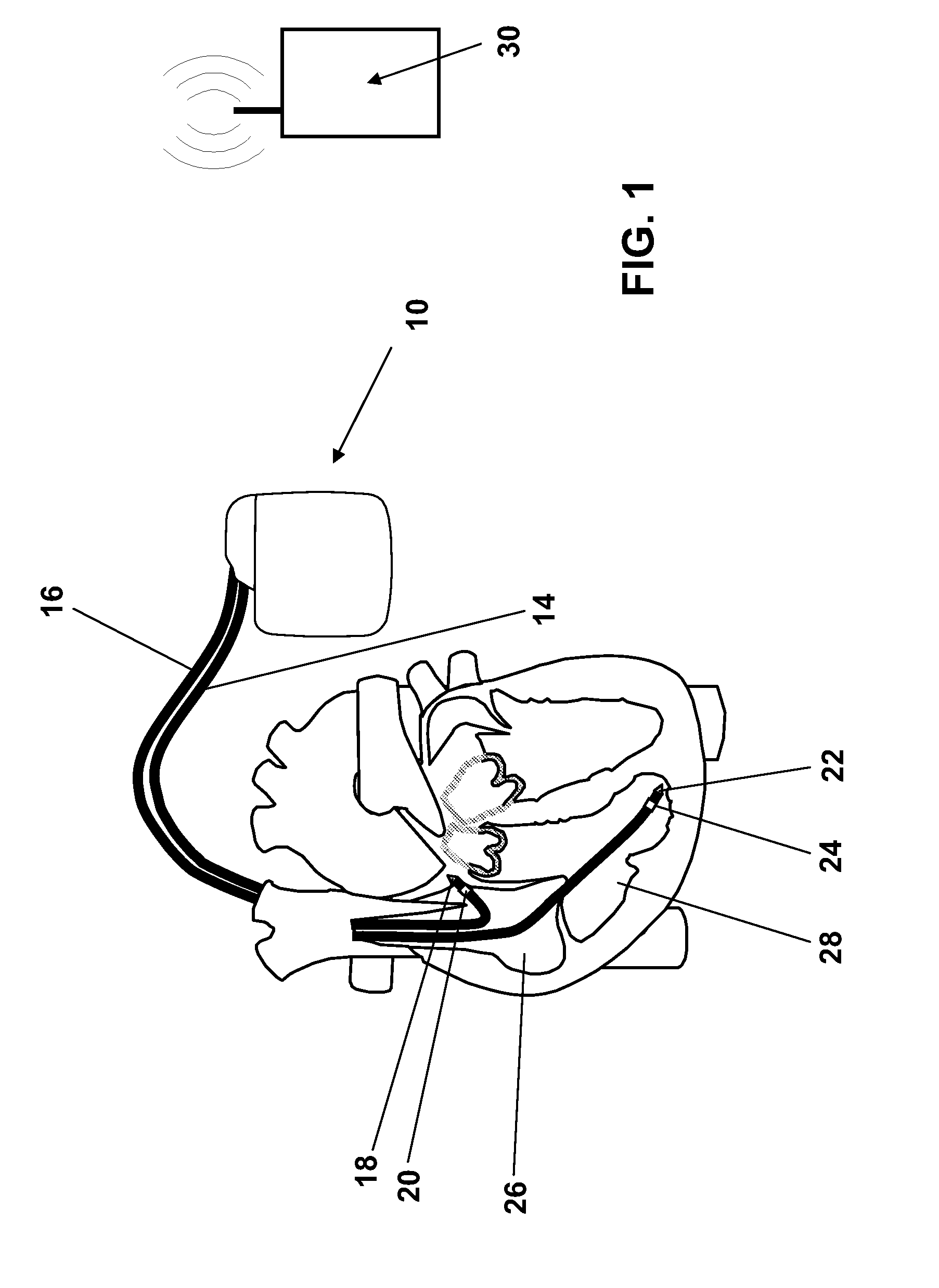 Technique for determining signal quality in a physiologic sensing system using high frequency sampling