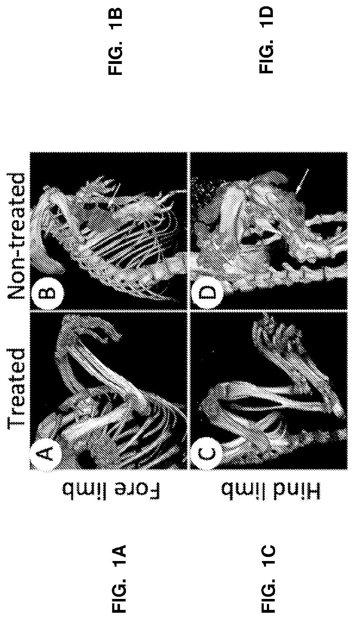 Selective RARy Ligand-loaded nanoparticles for manipulation of targeted bone growth