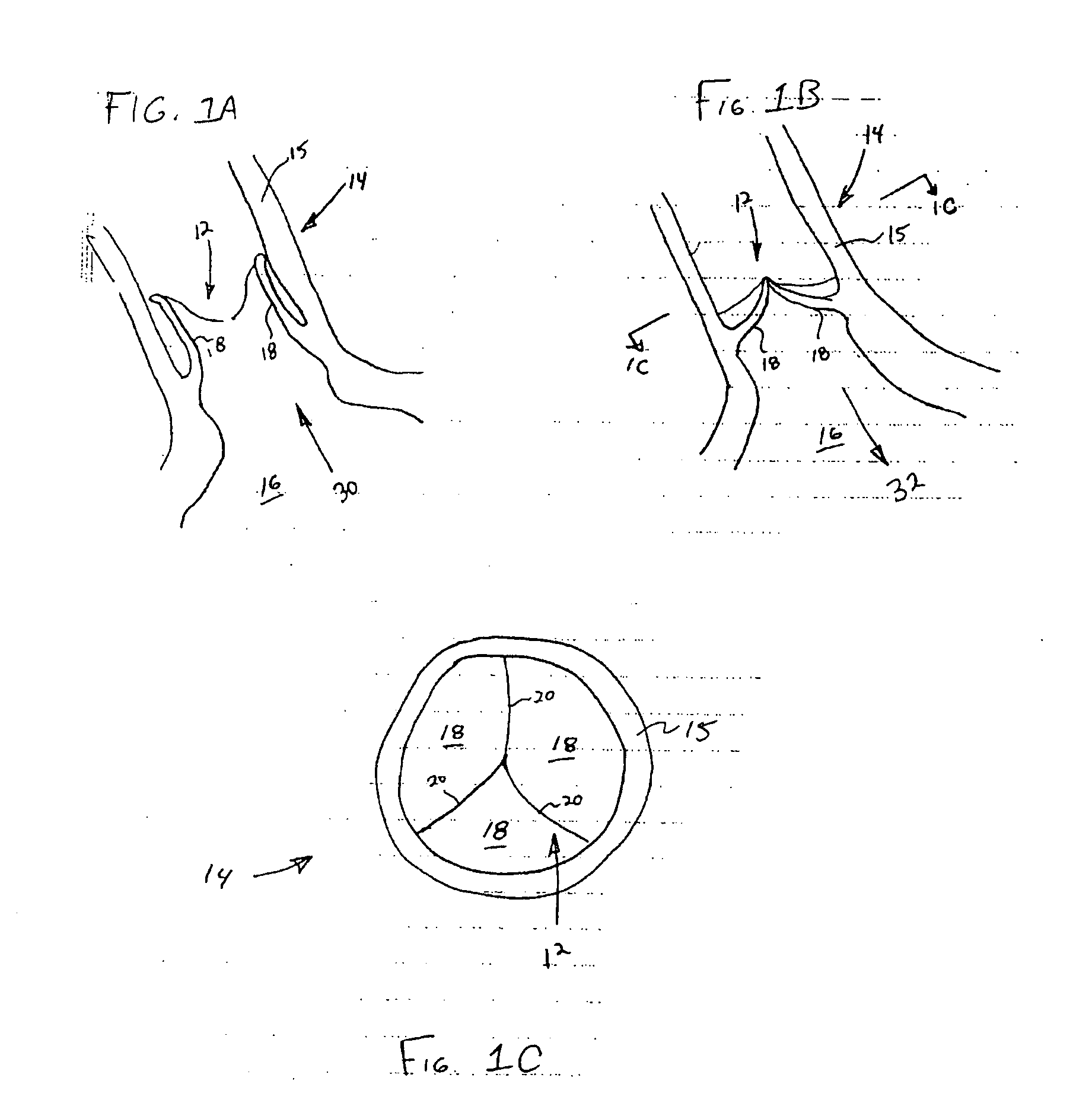 Prosthetic heart valves, support structures and systems and methods for  implanting the same,