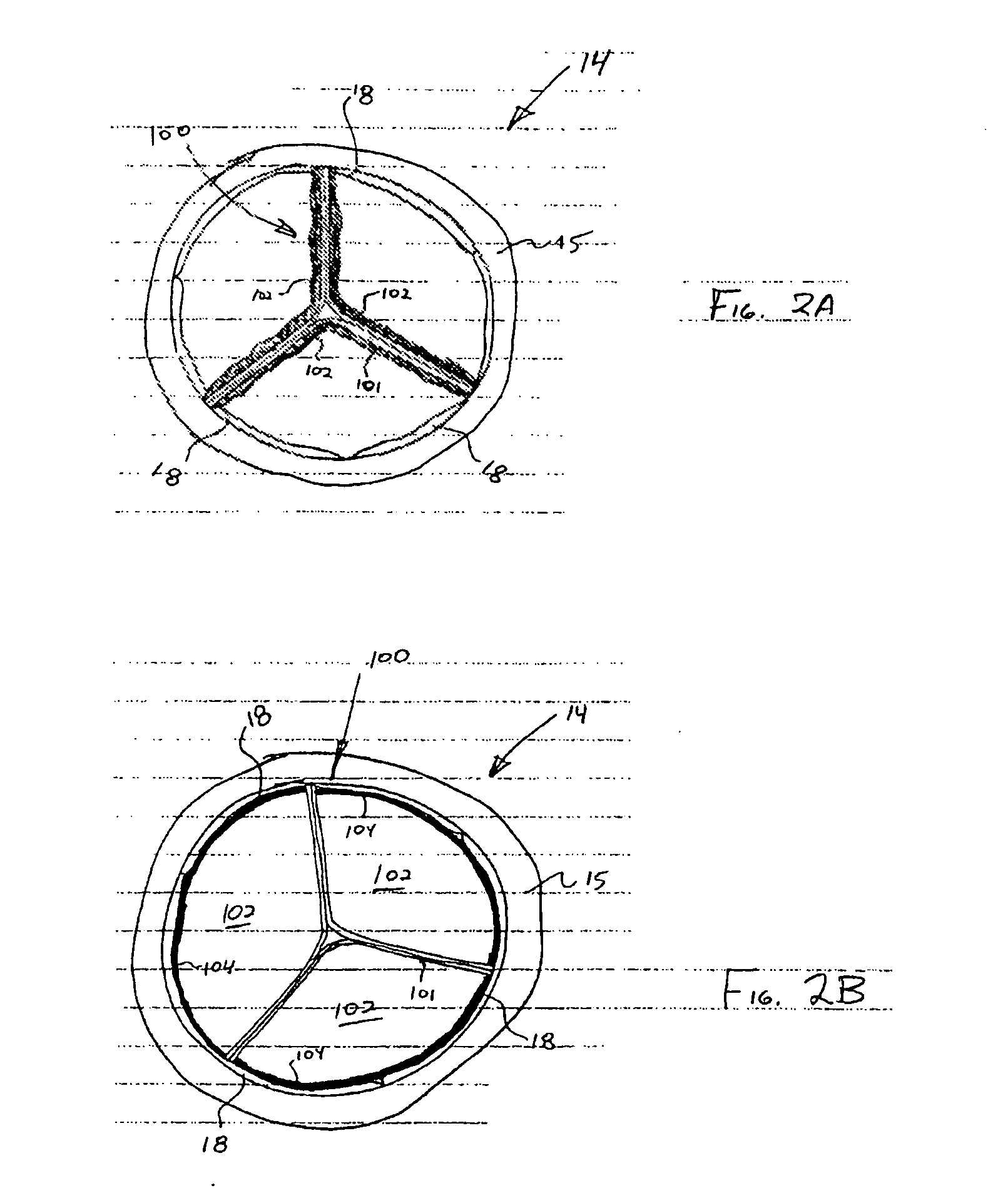 Prosthetic heart valves, support structures and systems and methods for  implanting the same,