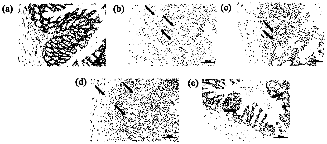 Application of litchi pulp polyphenol extract in preparation of preparation for improving ulcerative colitis