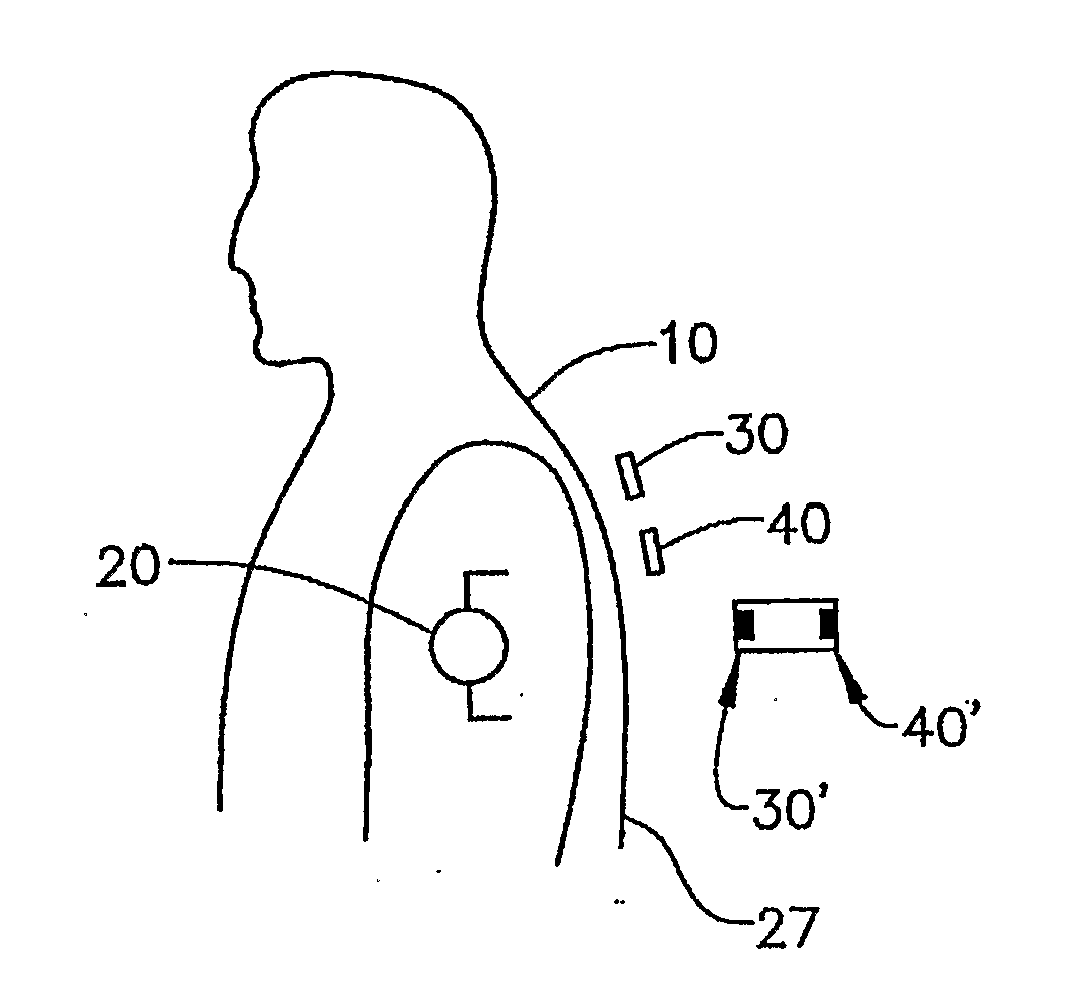 Sensor system for measuring an electric potential signal of an object