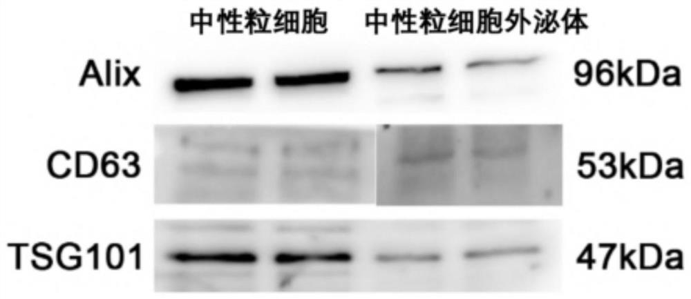 Blood-brain barrier penetrating drug delivery system as well as preparation method and application thereof