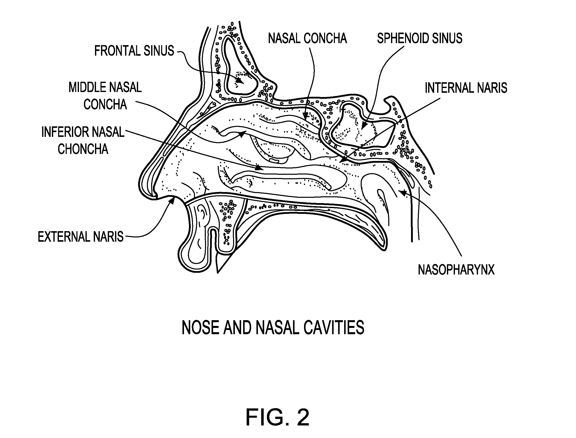 Methods for detecting antibodies in mucosal samples and device for sampling mucosal material