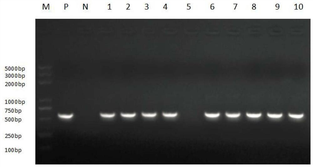 Degradation type glyphosate-resistant gene, plant expression vector, and cultivation method and application of degradation type glyphosate-resistant transgenic rice