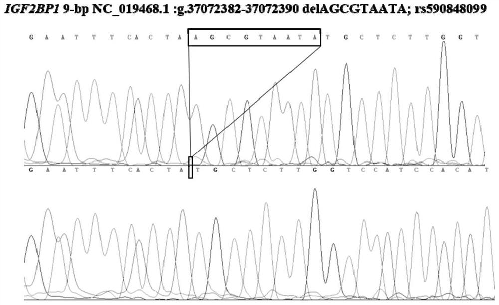 A DNA detection method and its application for detecting breast depth traits of Luxi black rams