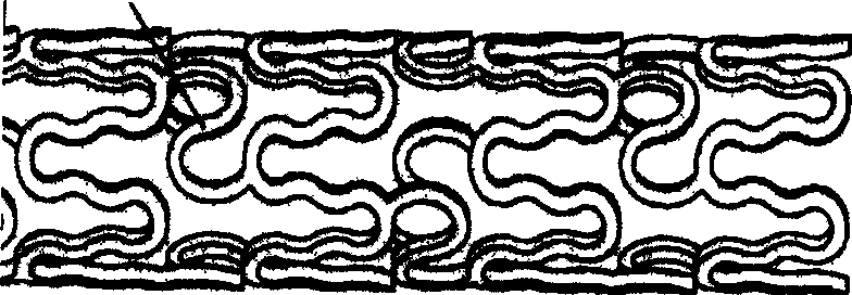 Centrosymmetric conjugation type equidistant constrictor for cylindrical net support