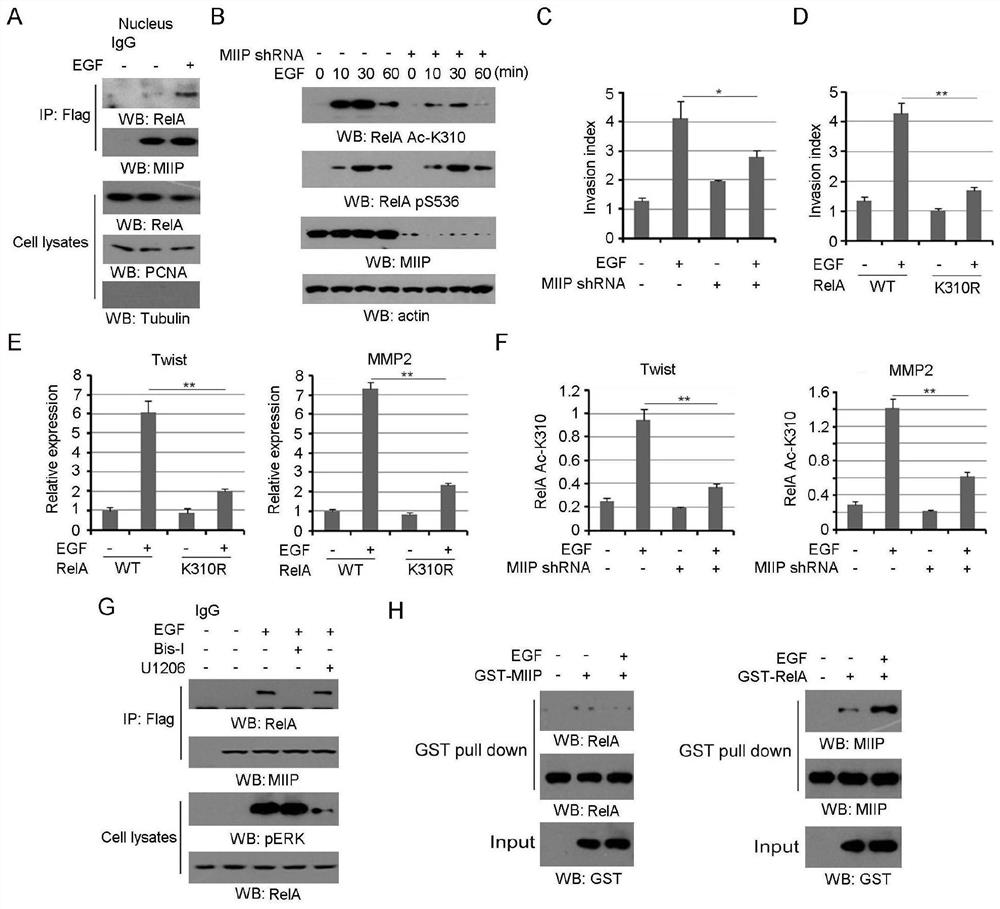 Application of miip pS303 blocker in the preparation of antitumor drugs