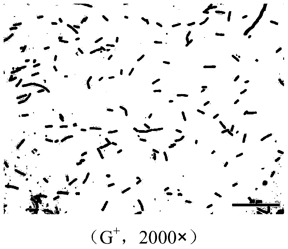 Screening and application of a probiotic Bacillus licheniformis with high production of compound enzyme