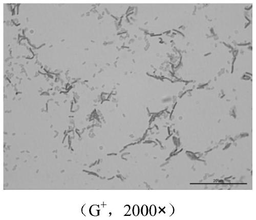 Screening and application of a probiotic Bacillus licheniformis with high production of compound enzyme