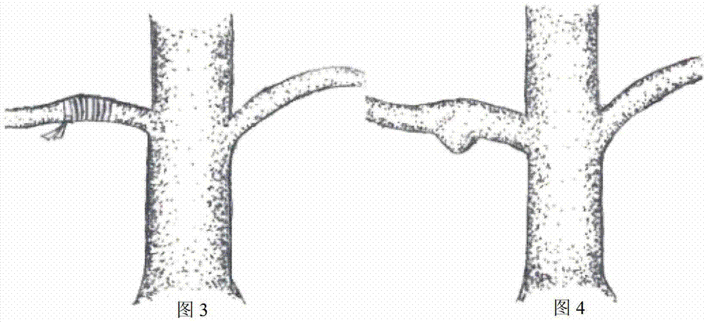 Mastoptosis-shaped burl forming method of ginkgo trees by artificial induction