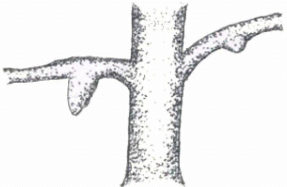 Mastoptosis-shaped burl forming method of ginkgo trees by artificial induction