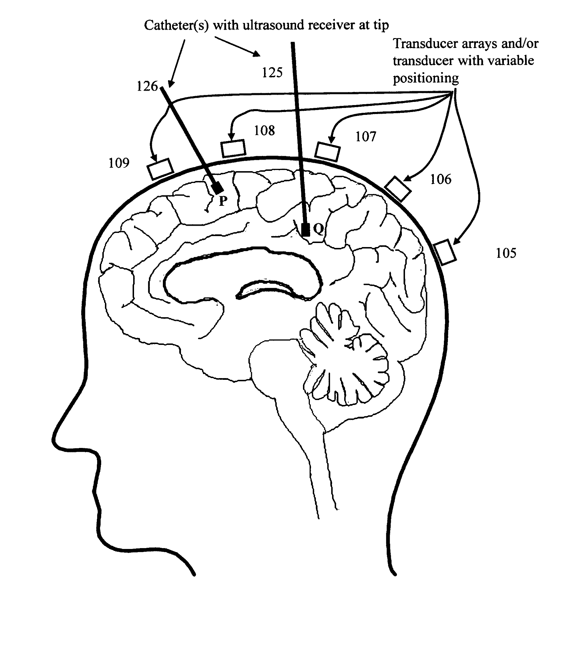 Device, methods, and control for sonic guidance of molecules and other material utilizing time-reversal acoustics