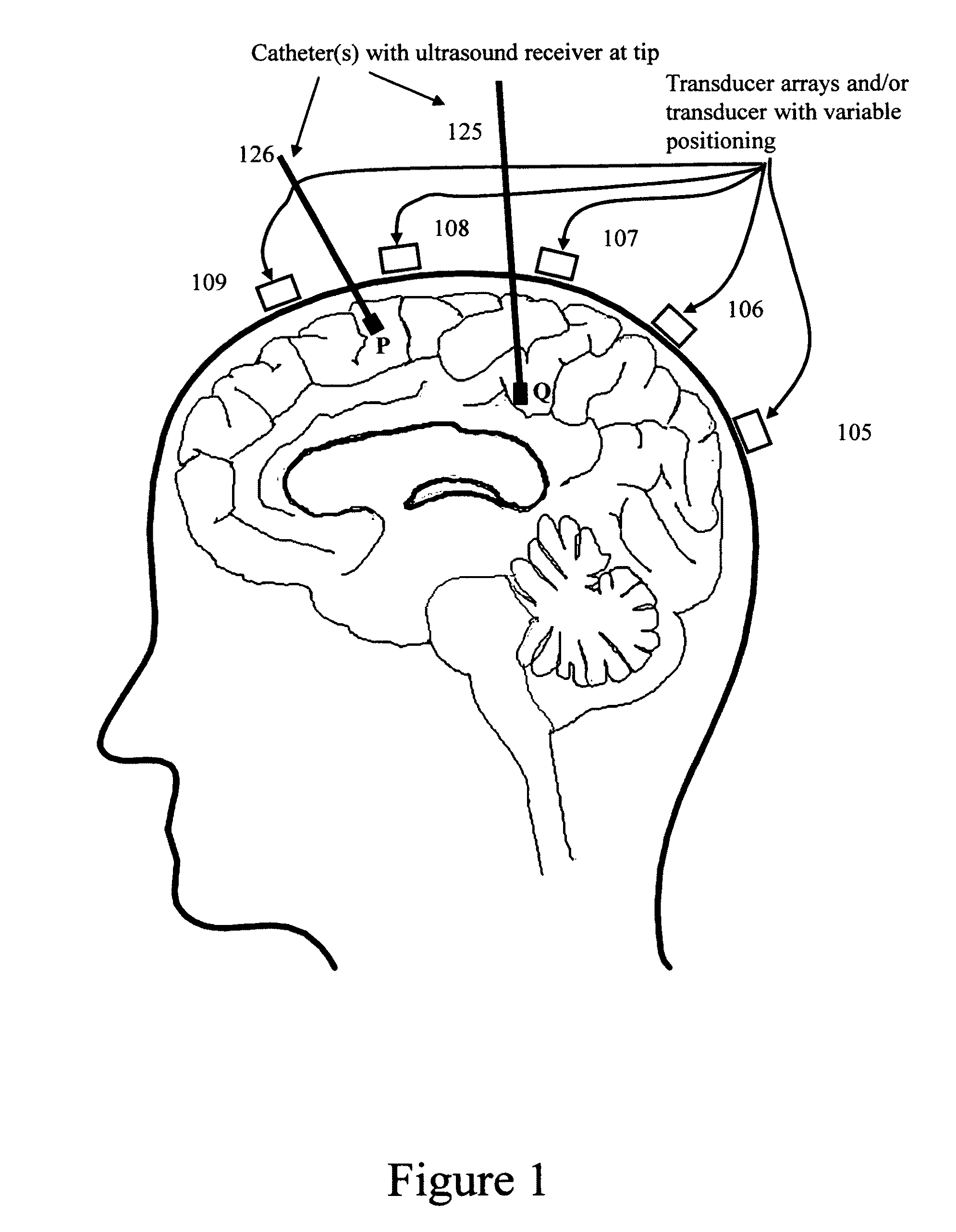 Device, methods, and control for sonic guidance of molecules and other material utilizing time-reversal acoustics