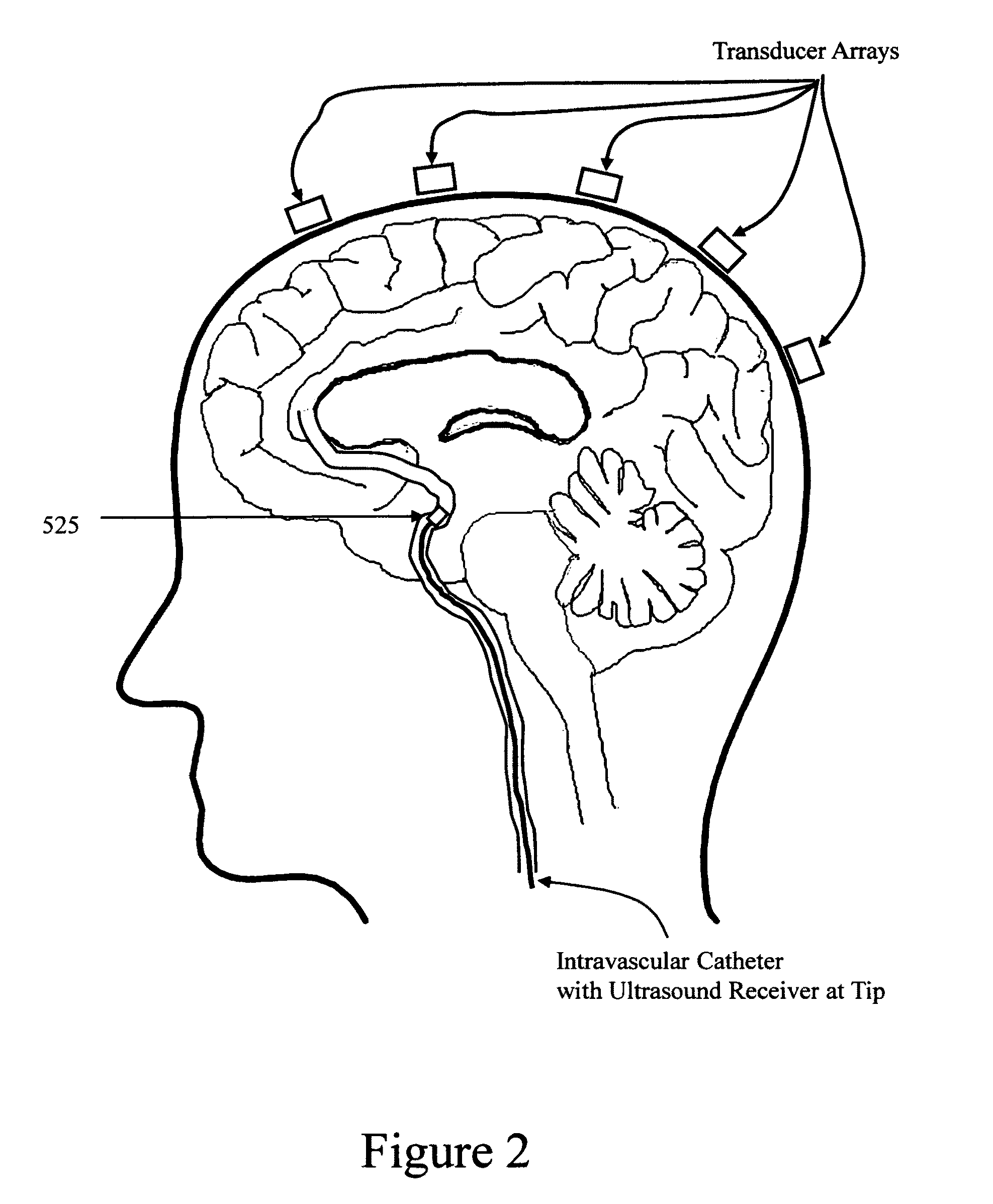 Device, methods, and control for sonic guidance of molecules and other material utilizing time-reversal acoustics