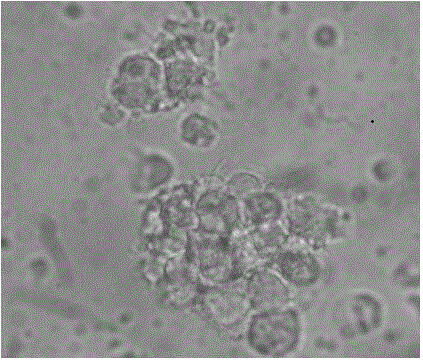 Brucella Omp10 protein antigen epitope polypeptide and application thereof