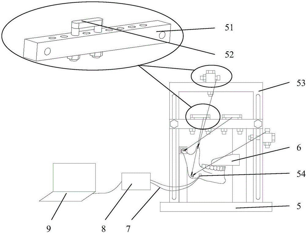 Personalized lower jawbone biomechanics model stress measurement system