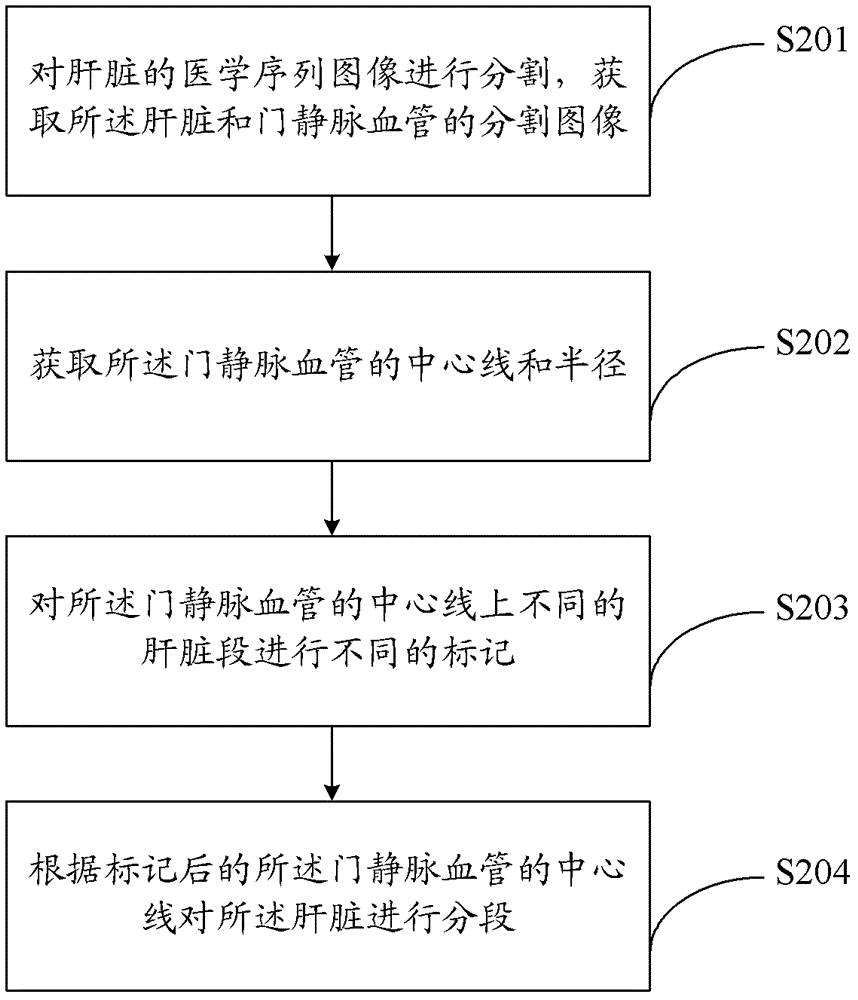 Method and system for liver segmentation