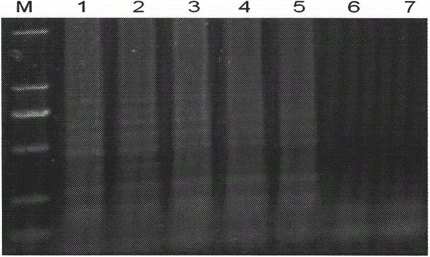 Method for detection of turnip mosaic virus using reverse transcription loop-mediated isothermal amplification technique