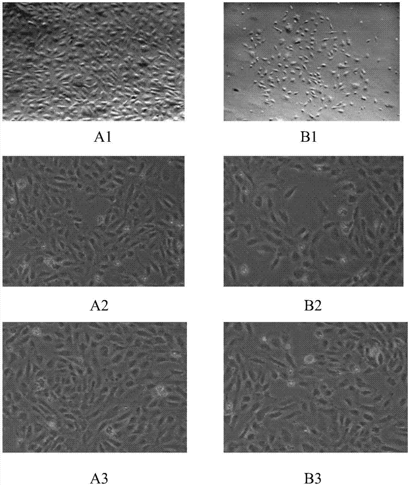 Separation culture method for endothelial progenitor cells and kit of method