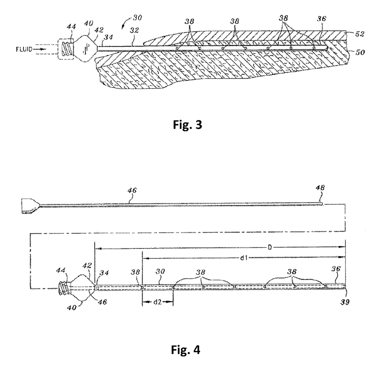 Tumescent infiltration drug delivery of high subcutaneous drug concentrations with prolonged local and systemic effects and minimal local or systemic toxicity