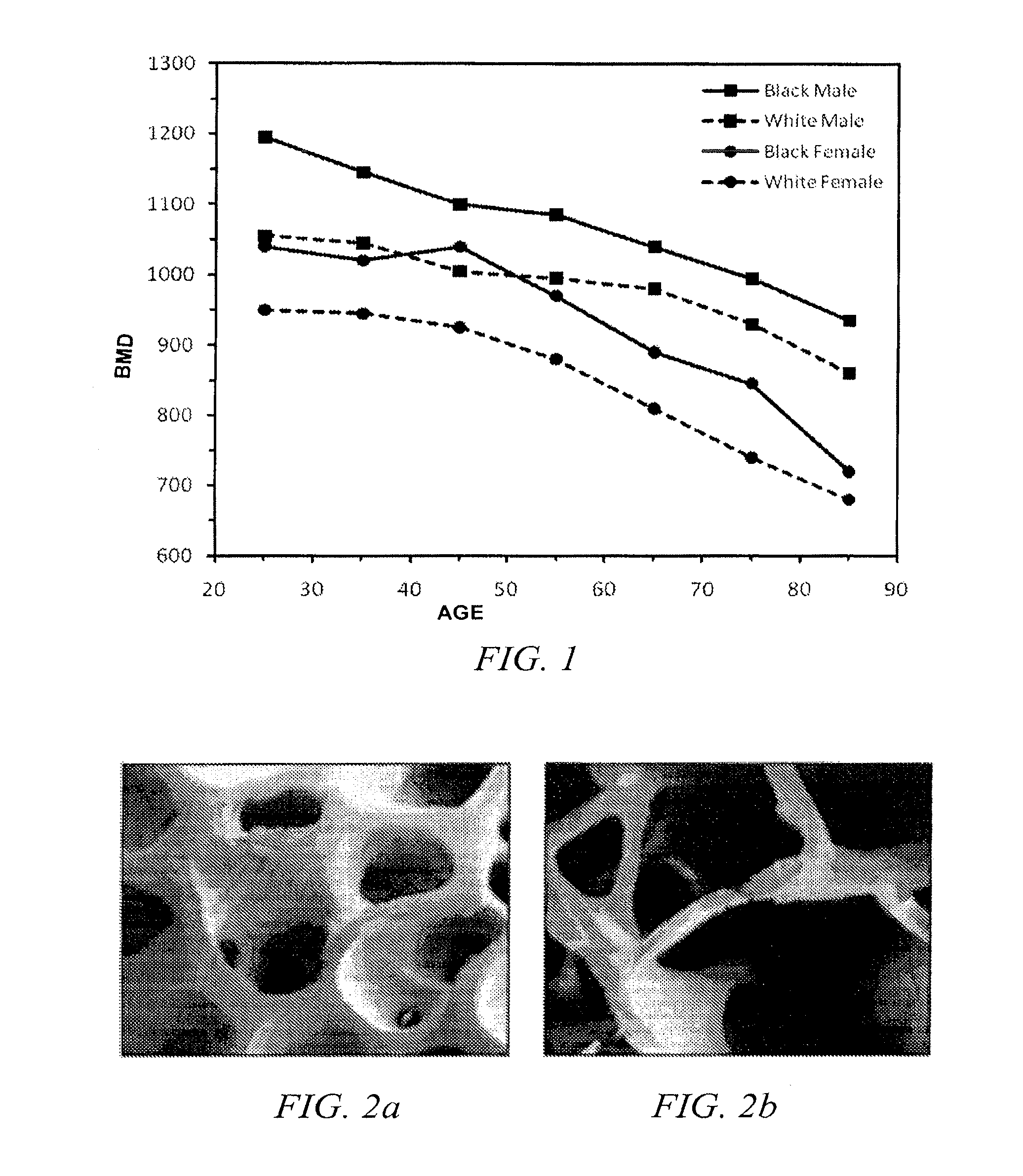 Methods of treating degenerative bone conditions