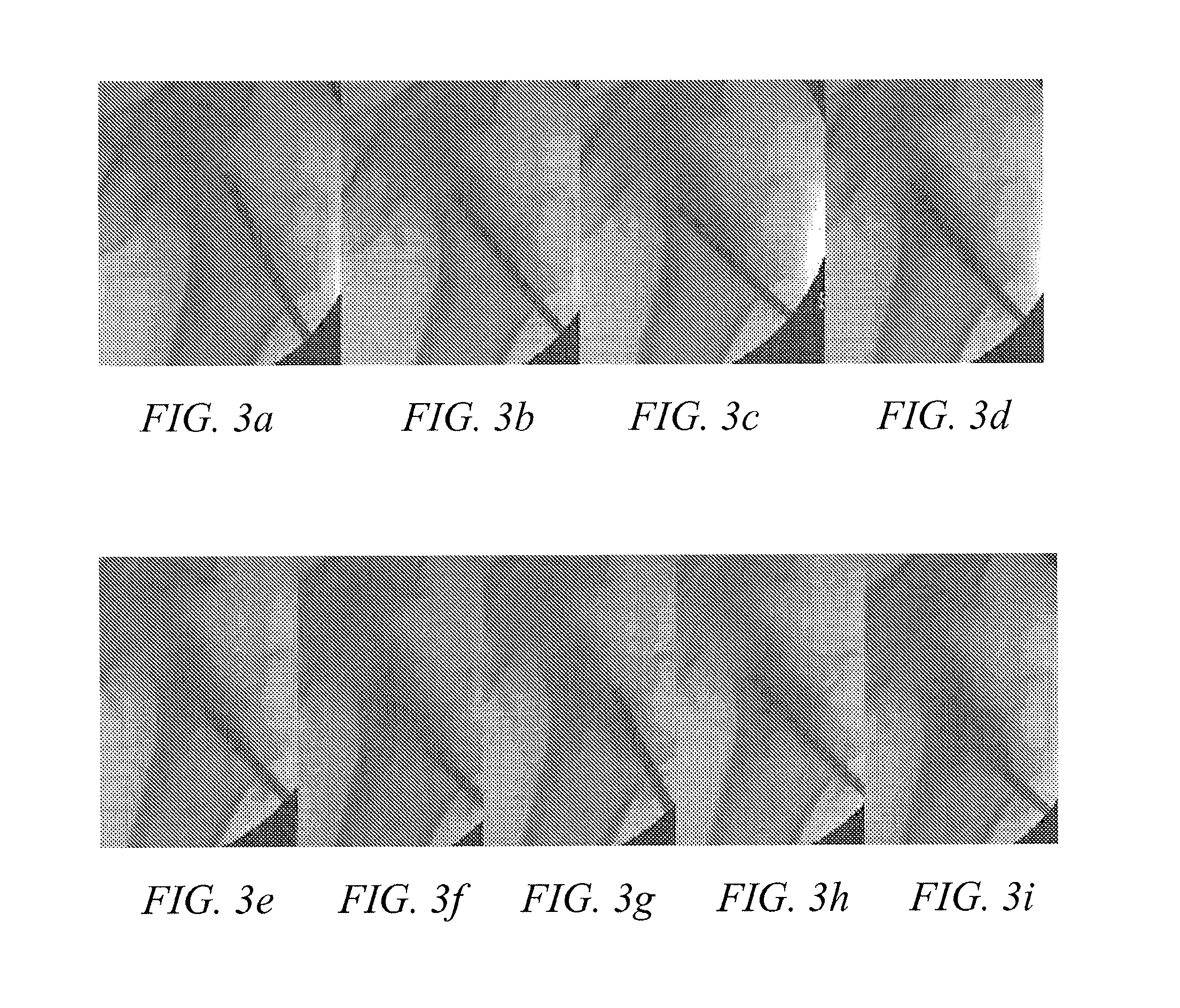 Methods of treating degenerative bone conditions