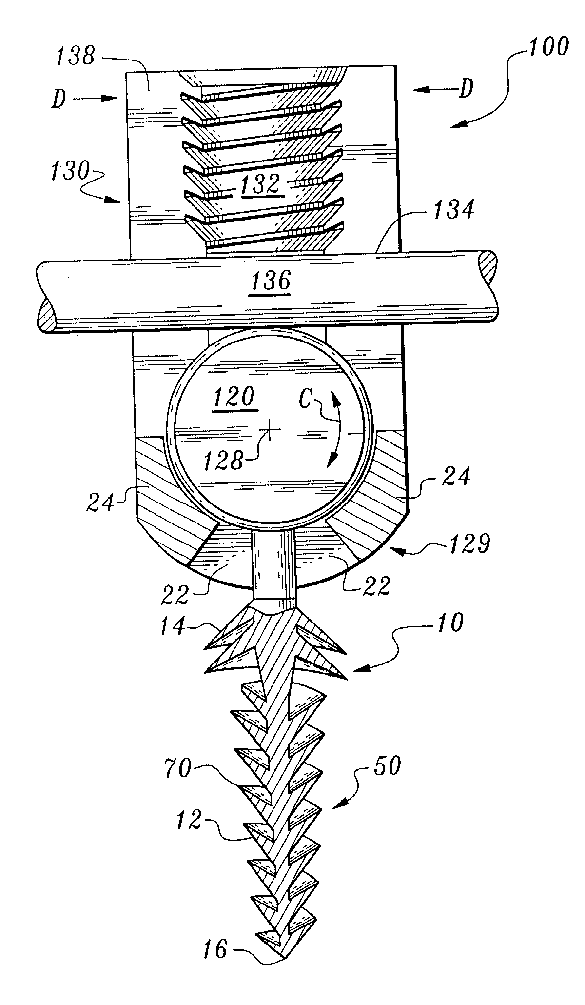 Orthopedic stabilization device and method