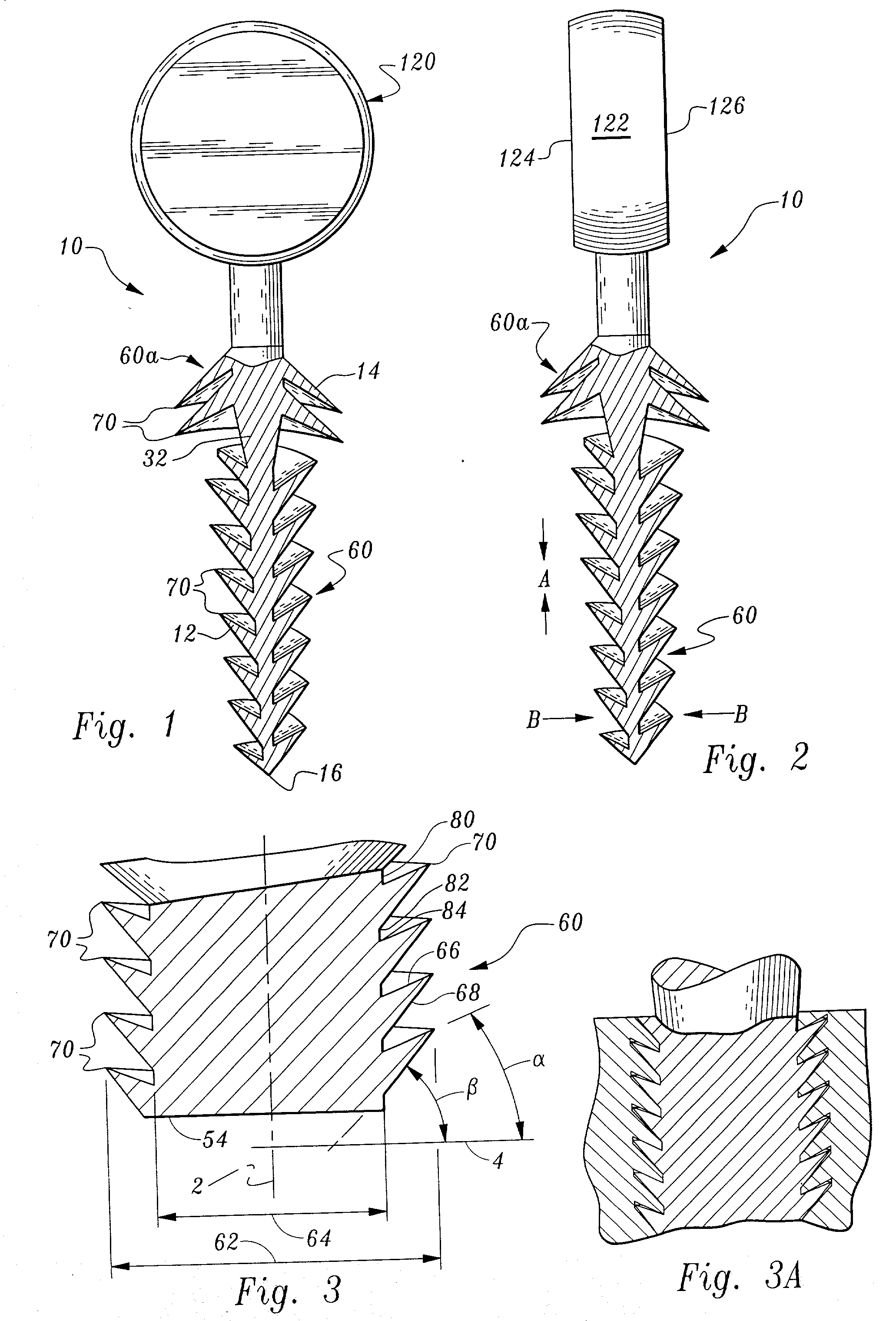 Orthopedic stabilization device and method