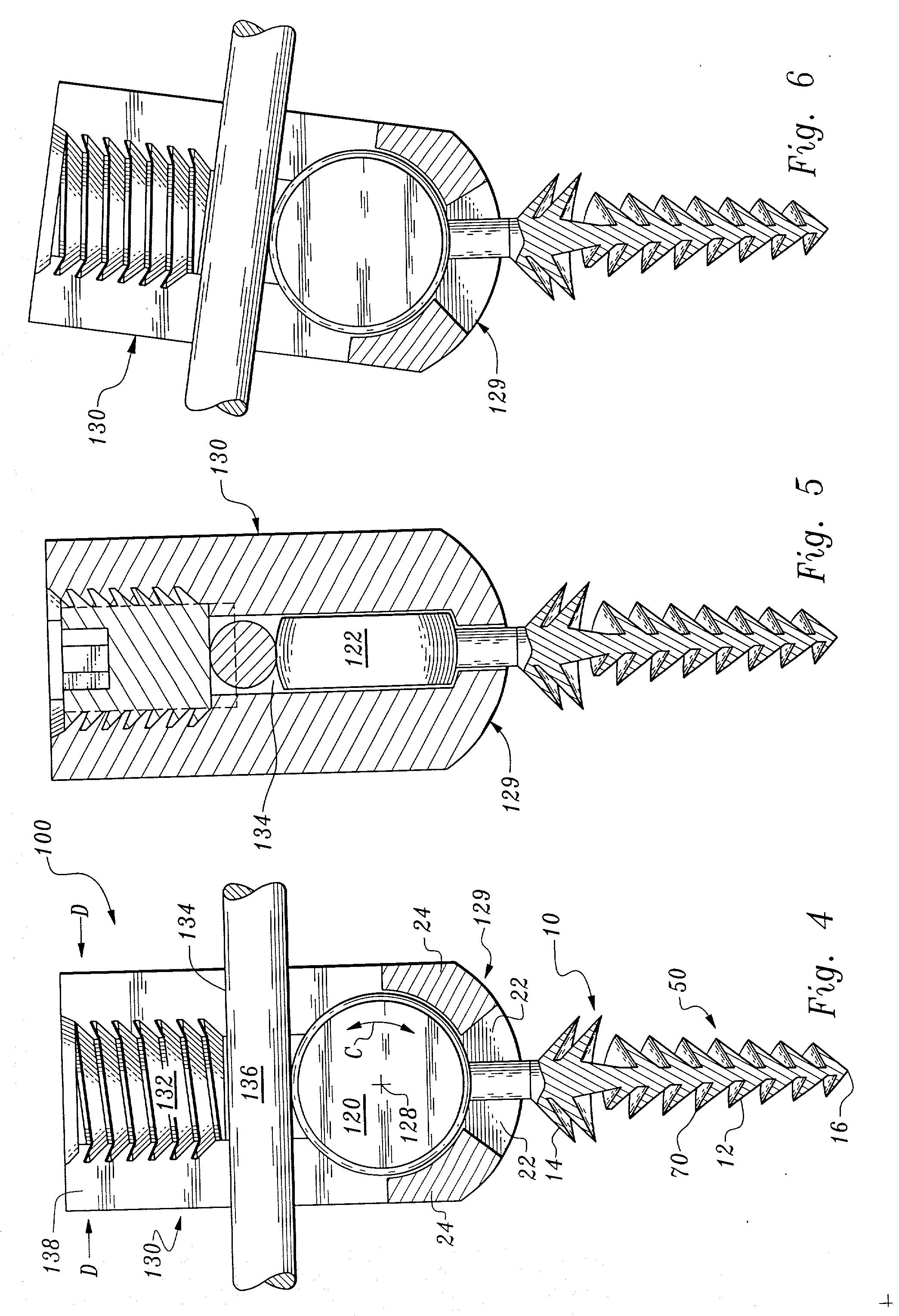 Orthopedic stabilization device and method