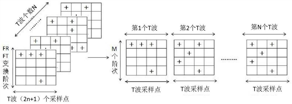 Electrocardio T-wave feature extraction method based on fractional Fourier transform and tensor decomposition