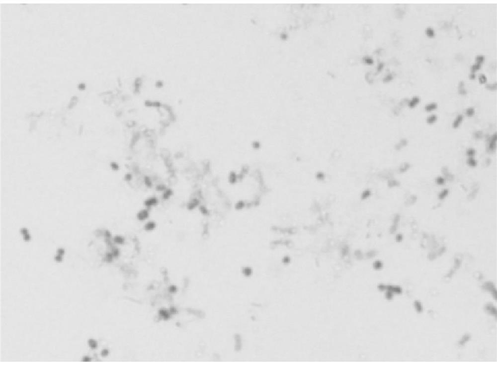 Methylobacterium with denitrification function and hypoxia stress resistance and application thereof