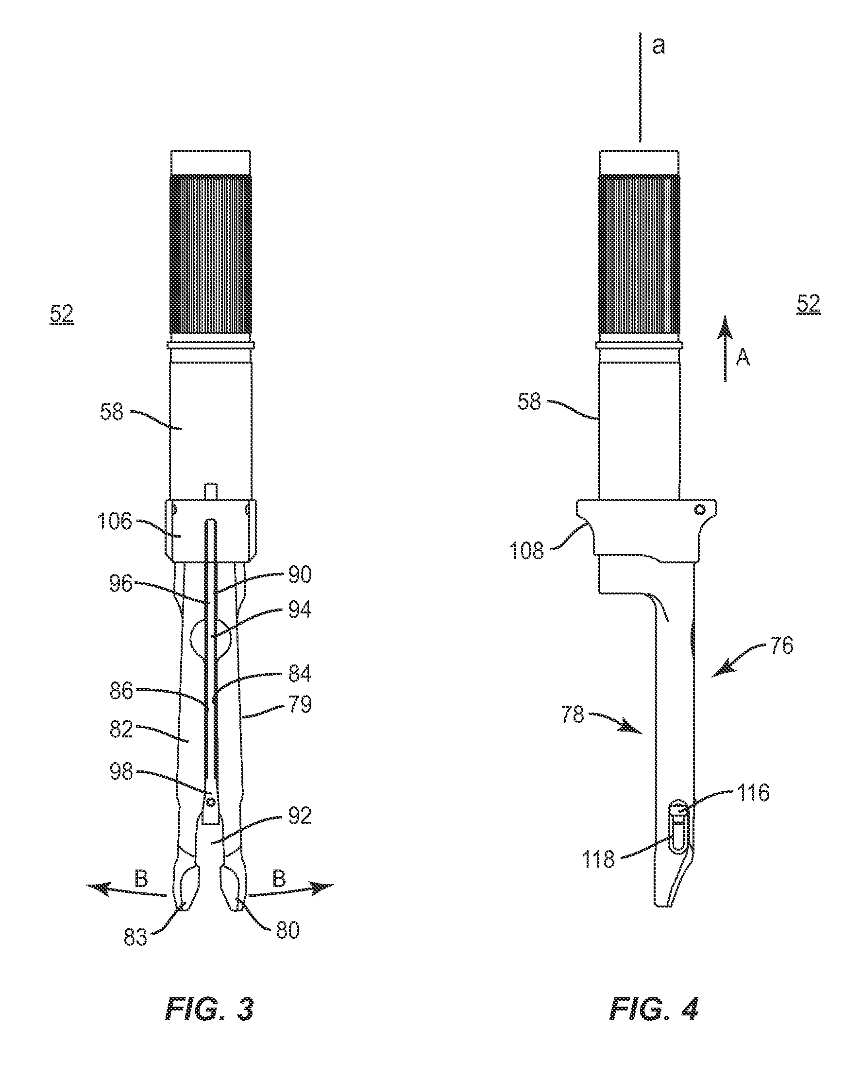 Spinal rod system and method