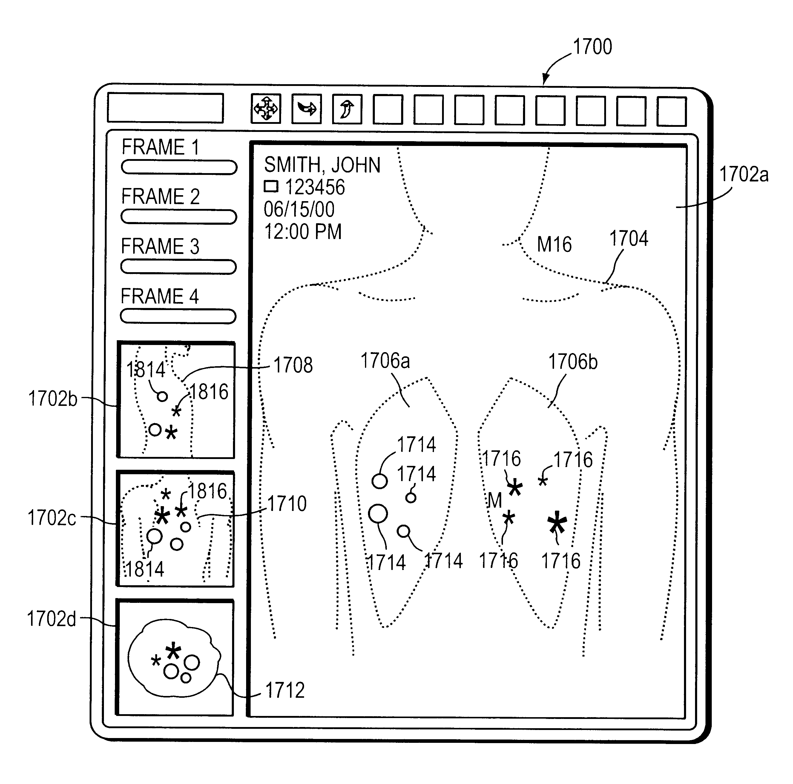 Method and apparatus for displaying body sounds and performing diagnosis based on body sound analysis